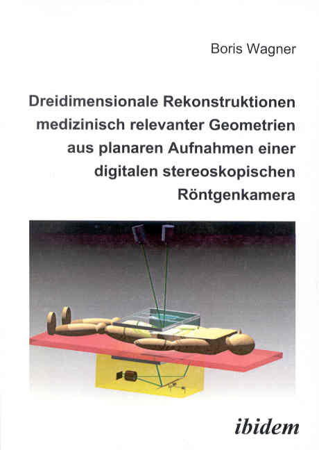 Boris Wagner: Dreidimensionale Rekonstruktionen medizinisch relevanter Geometrien aus planaren Aufnahmen einer digitalen stereoskopischen Röntgenkamera 
